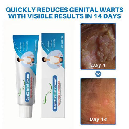 🌈🌞 Sale🌞🔥30-Day Free Returns💰lirayn HPV Genital Warts Relief Cream