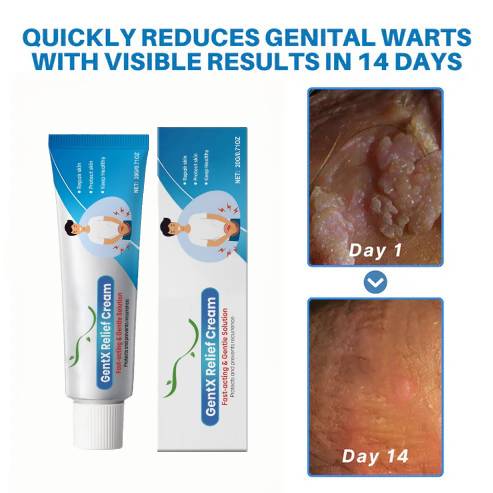 🌈🌞 Sale🌞🔥30-Day Free Returns💰lirayn HPV Genital Warts Relief Cream
