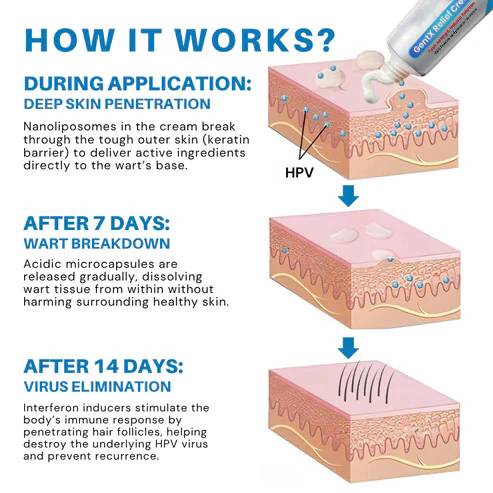🌈🌞 Sale🌞🔥30-Day Free Returns💰lirayn HPV Genital Warts Relief Cream